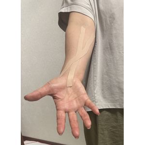 テーピング